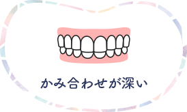 かみ合わせが深い